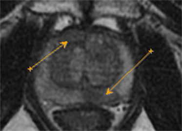 ultrazvukovoe issledovanie s elastografiej 02