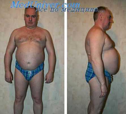 больной сахарным диабетом