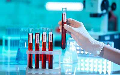 Анализ крови на хронический алкоголизм - Веримед