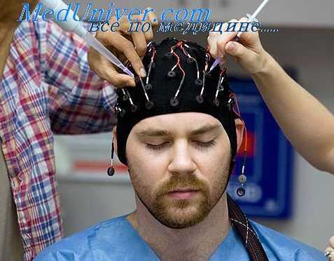 височная эпилепсия