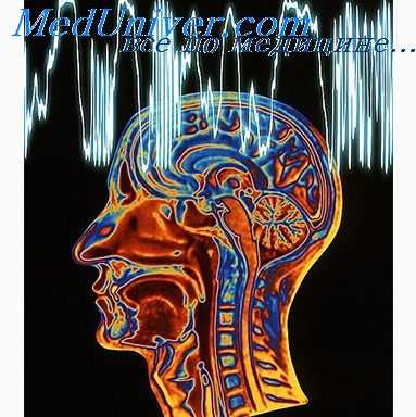 височные припадки