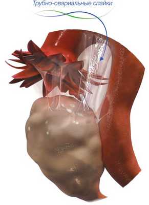 Маточные трубы