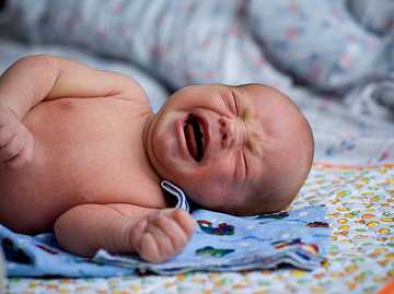 Фото Стеноз легочной артерии у новорожденных