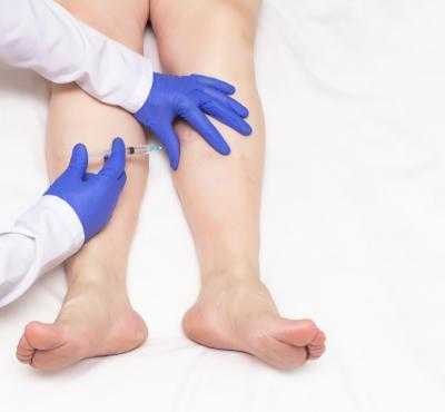 FILM-склеротерапия