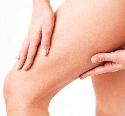 Эндовазальная лазерная коагуляция (ЭВЛК)