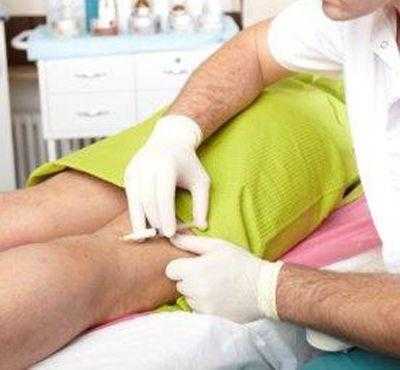 Склеротерапия