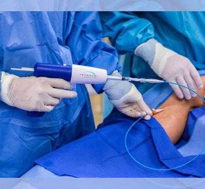 Клеевая облитерация вен VenaSeal