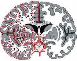 расширенные периваскулярные пространства
