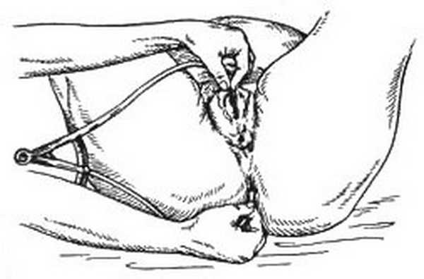 Таз с акушерской точки зрения