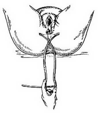Таз с акушерской точки зрения