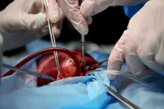 Клиника разрыва сердца