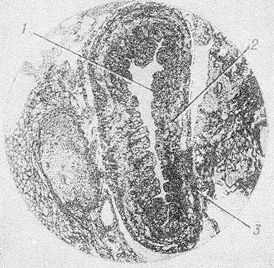 Рис. 4. Микропрепарат грудного протока: 1 — внутренняя оболочка; 2—средняя оболочка; 3 — наружная оболочка.