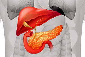 Аденома поджелудочной железы