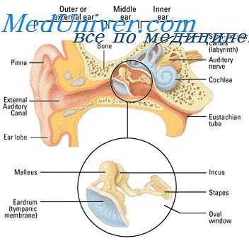 лечение отосклероза