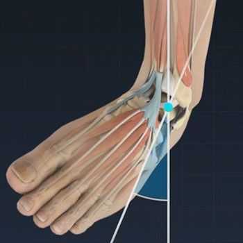 связки голеностопного сустава