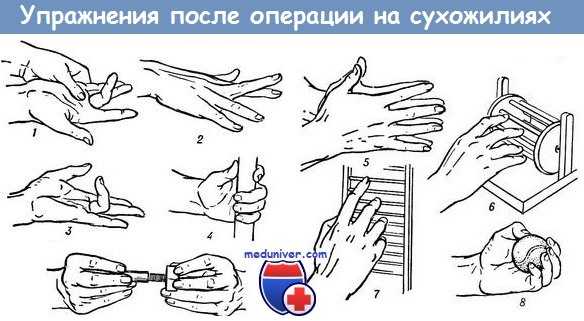 Упражнения для пальцев кисти