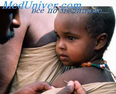 реактогенность вакцин