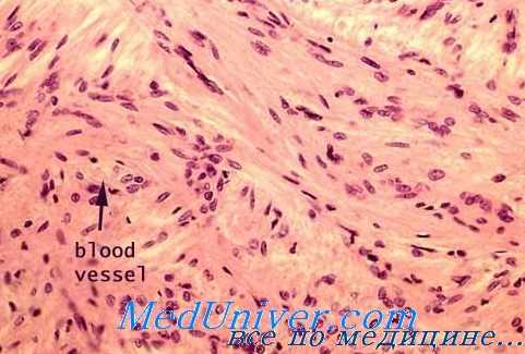 морфология гипоталамуса