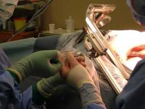 вмешательство на мозгу