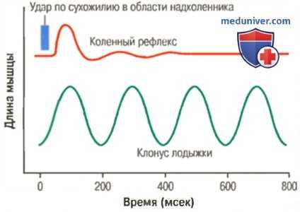 Рефлекс на растяжение в клинике. Клонус мышечных волокон