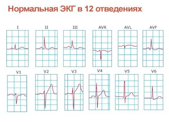 Стандартные отведения