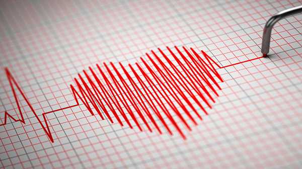 Правильная техника снятия ЭКГ