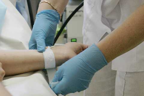 Закрепление на руке накожного электрода эндоскопического рН-зонда