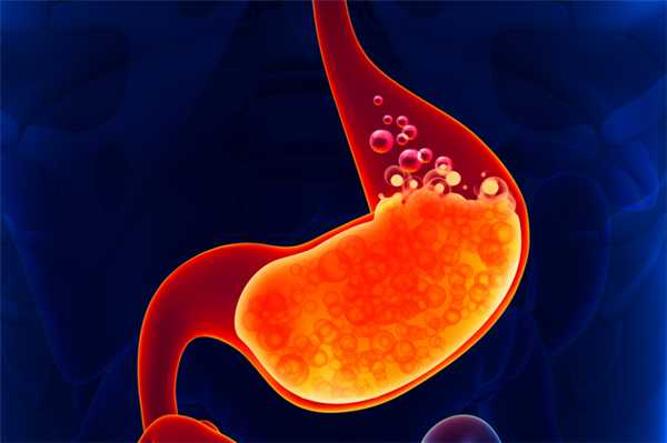 Повышенная кислотность желудка