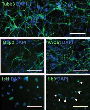 Рис. 1. Моторные (двигательные) нейроны, полученные из стволовых клеток