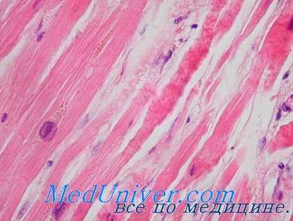 расслабление миокарда