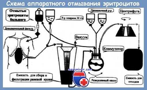 реинфузия крови