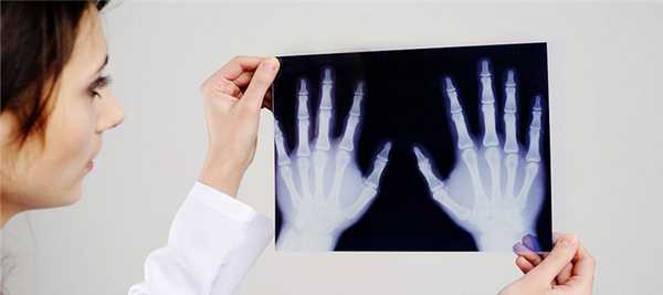 Рентген кистей рук