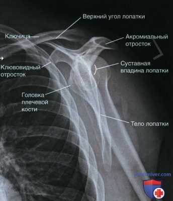 Укладка при рентгенограмме плечевого сустава в косой ЗП проекции (лопаточной Y проекции)