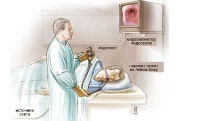 Гастроскопия
