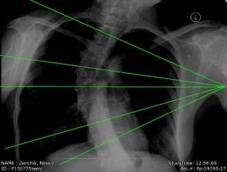 Обратите внимание какие типы рентгенографии существуют