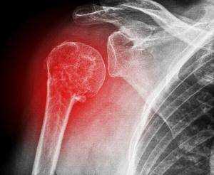 Атлас укладок при рентгенологических исследованиях (Кишковский А.Н.) - Глава 5 Часть 2