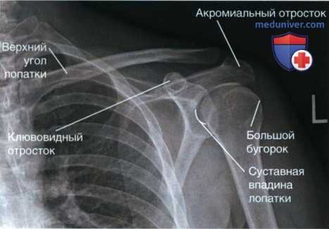 Укладка при рентгенограмме плечевого сустава в передне-задней проекции (ПЗ проекции)
