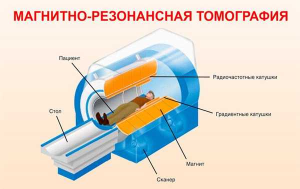 МРТ (Магнитно-резонансная томография)