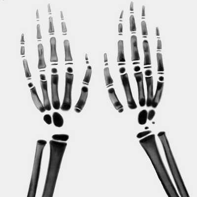 Рентген кисти