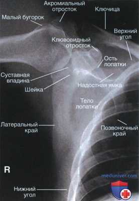 Укладка при рентгенограмме лопатки в ПЗ проекции
