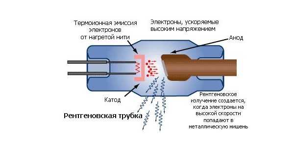 Принцип работы трубки в рентгеноскопе