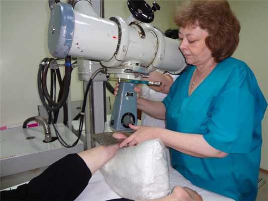 Rentgenoterapiya-pyatochnoj-shpory-1-e1478281603283.jpg