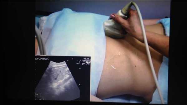 узи кишечника