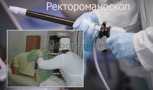 Что такое ректороманоскоп