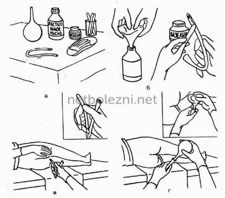 Как сделать очистительную клизму