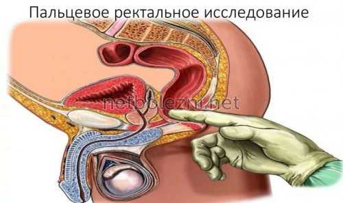 Пальцевое ректальное исследование