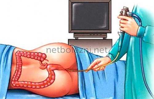 Исследование прямой кишки