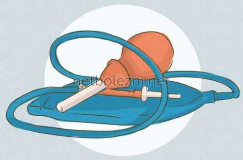 Клизма перед процедурой