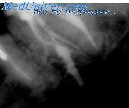 снимок зубов