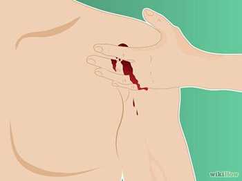 Огнестрельные ранения диагностика